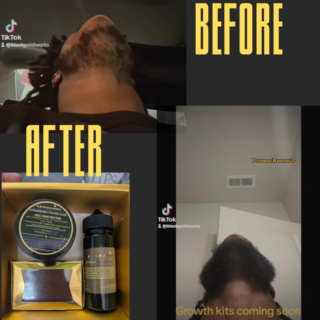 Hair/Beard Kit Ships free