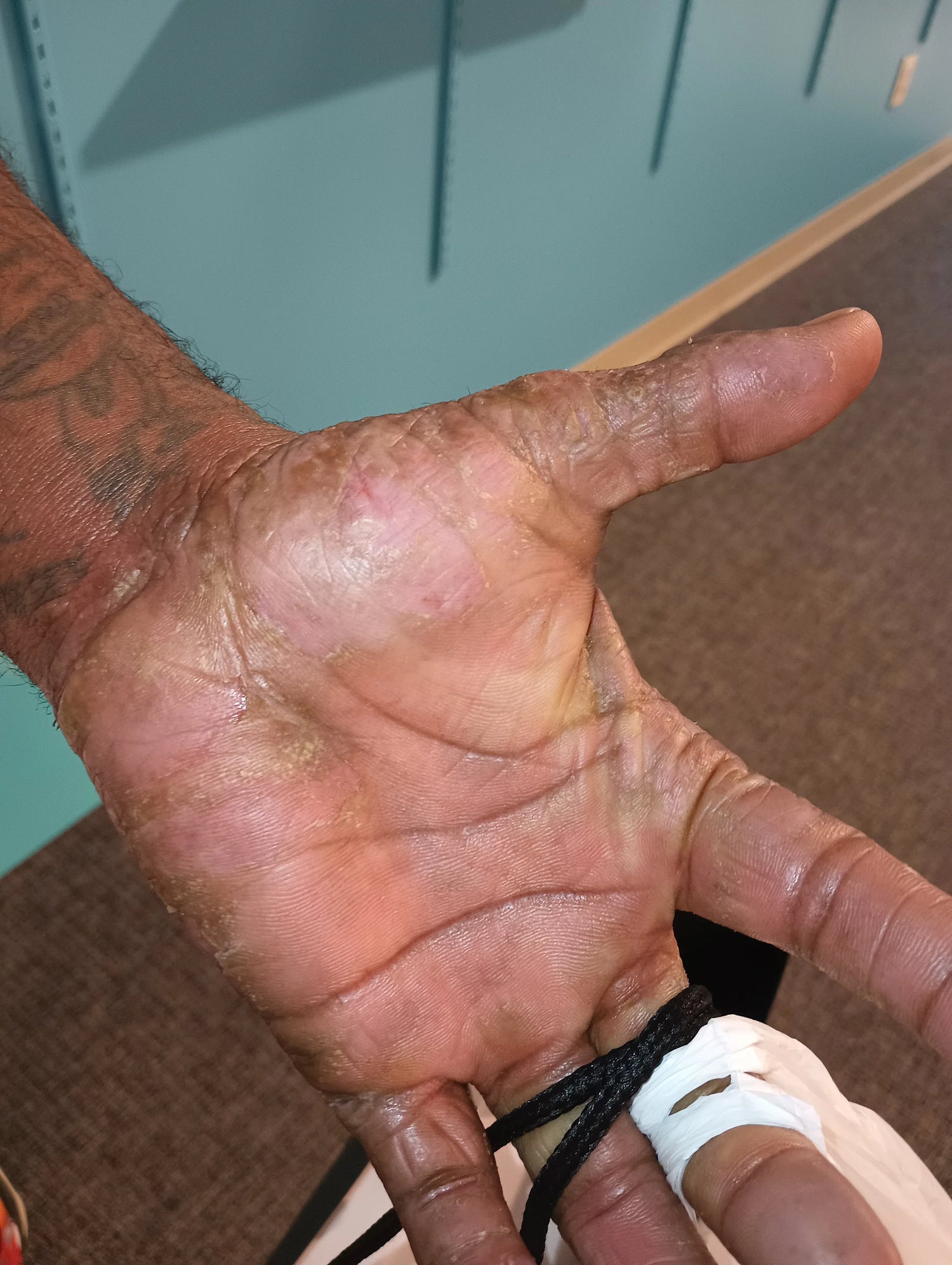 image comparison after