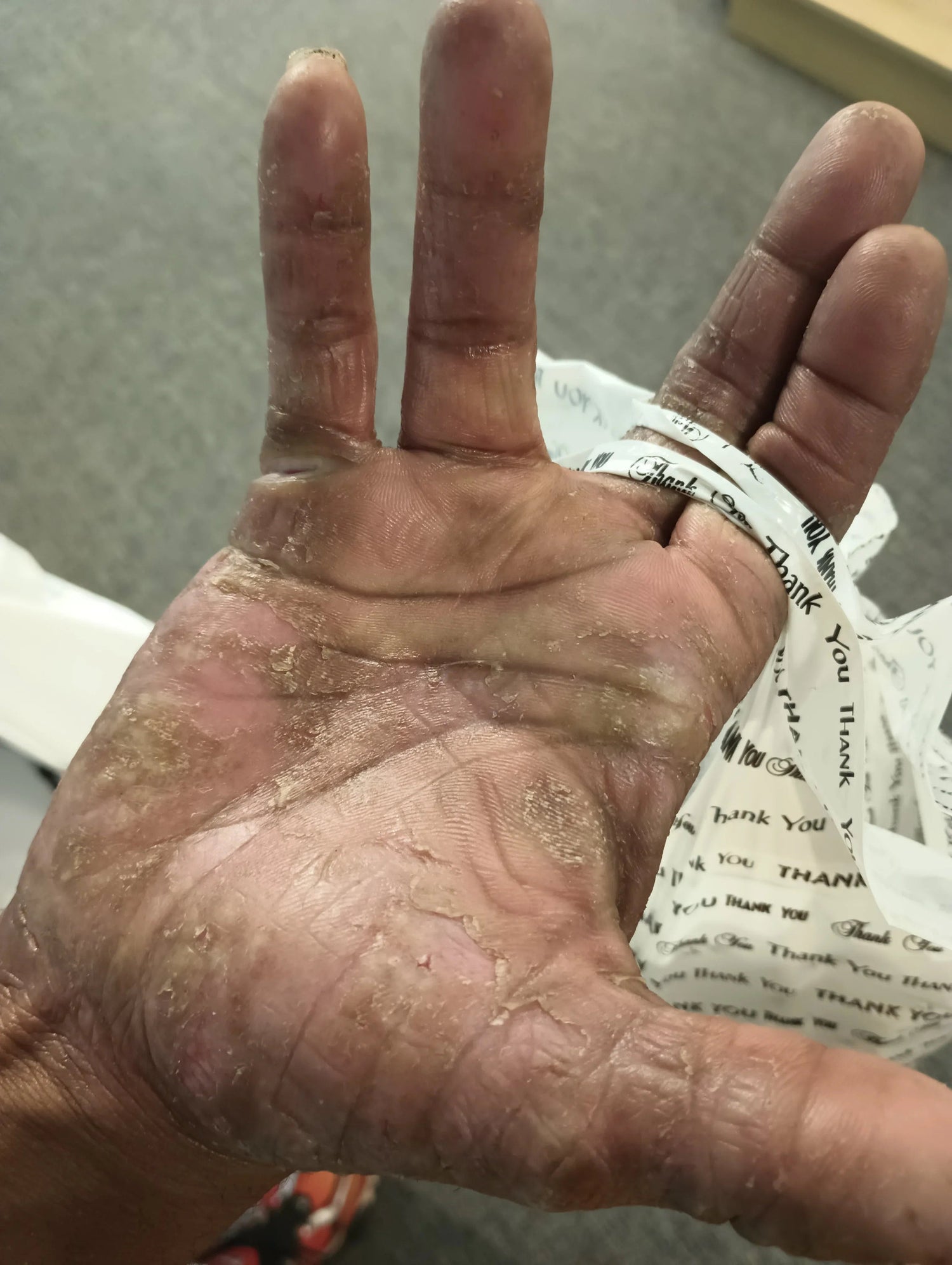 image comparison before