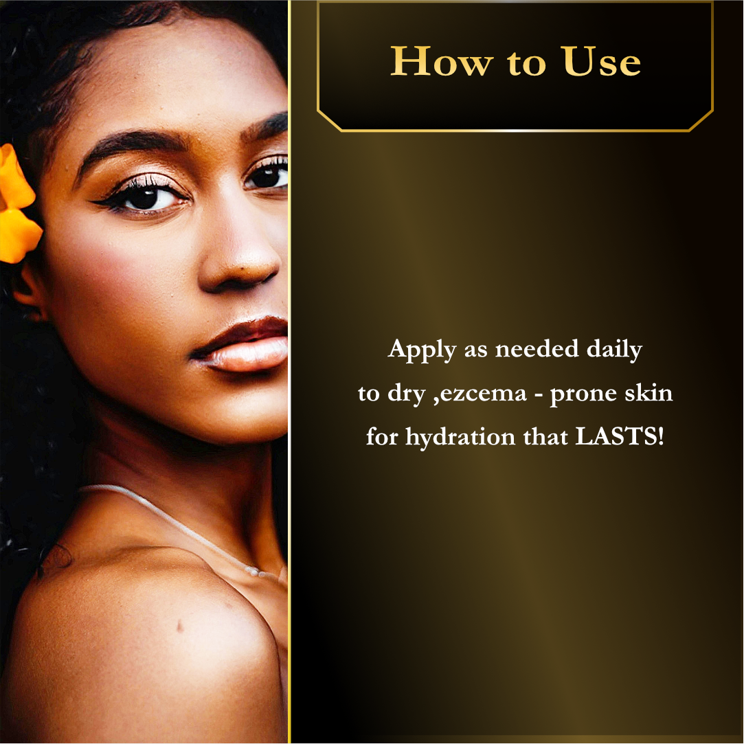 Eczema & Dry, Sensitive Skin Moisturizer (Buy 2 get 1 Must Add 3 to cart!!)