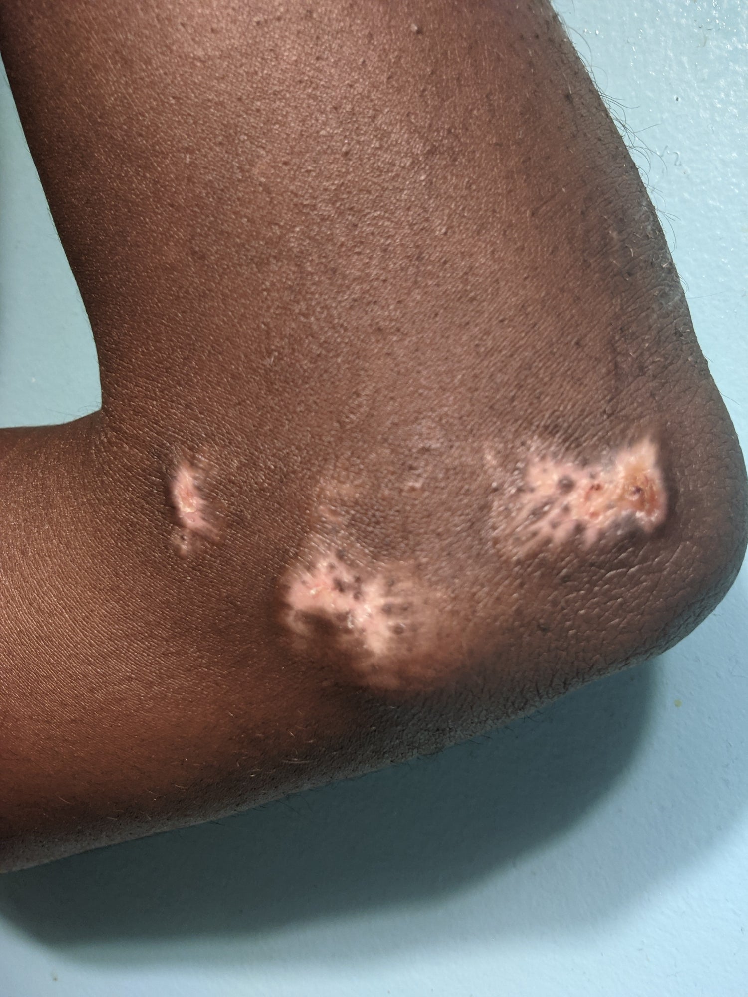 image comparison before