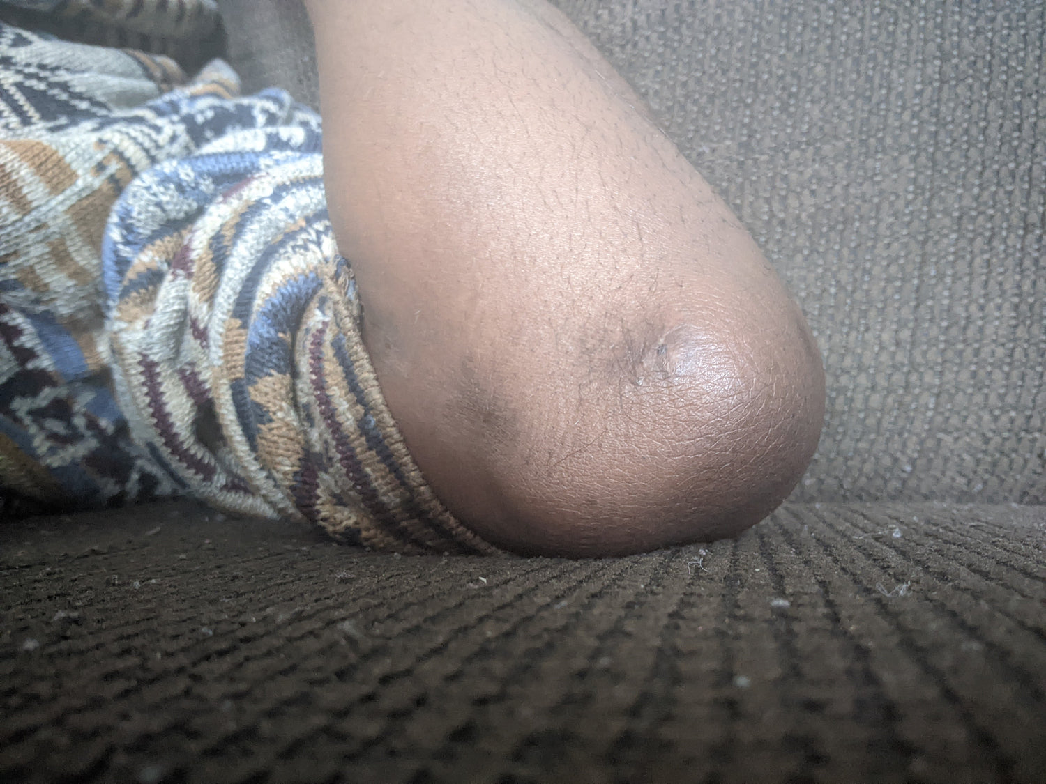 image comparison after