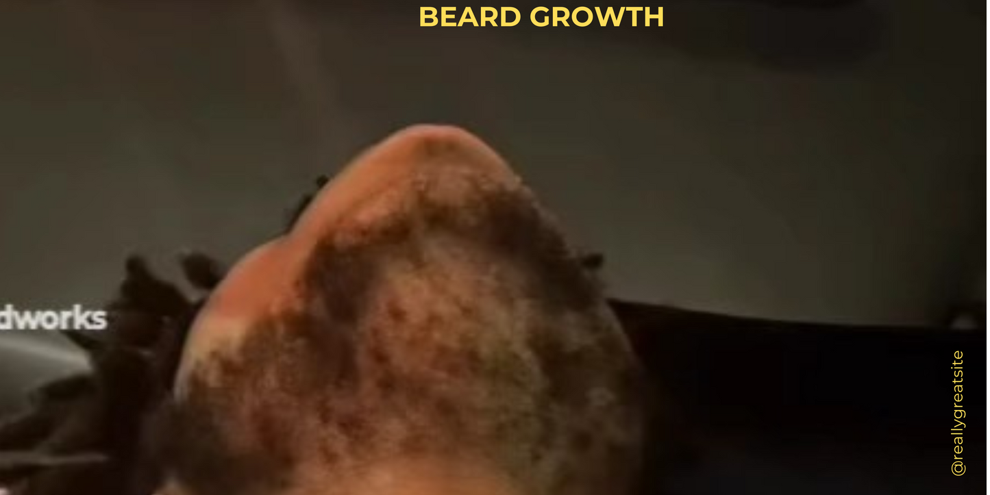 Silk Hair/Beard Growth Kit Ships free